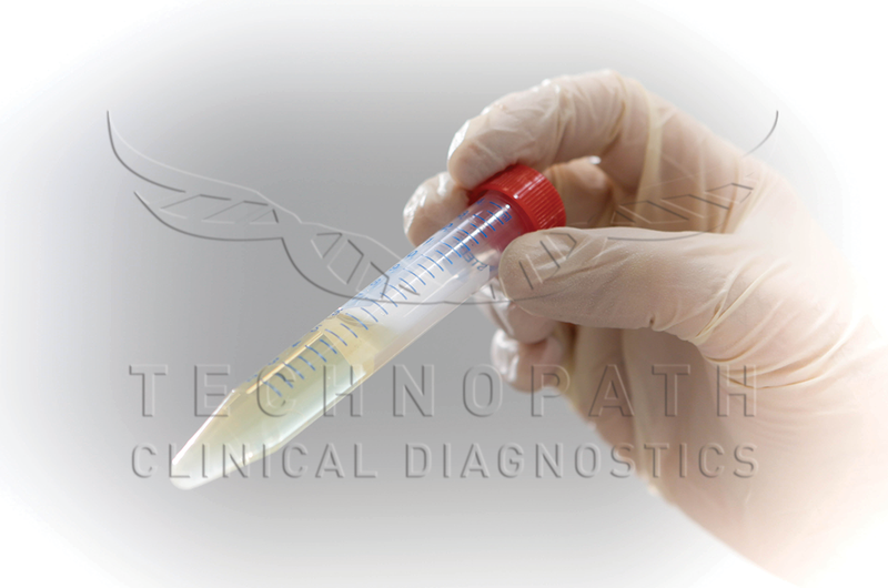 Technopath IVD Raw Materials Delipidised Human Serum in test-tube